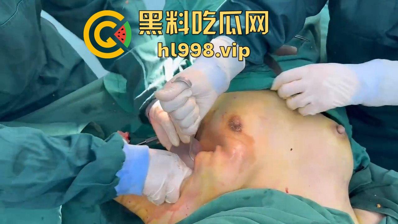 揭秘黄晓明女友『叶柯』同款隆胸术手术过程，看的让人心惊！胸被医生猛戳猛捣，视觉冲击强到不敢看！-8