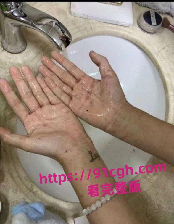 溧阳开放大学生化母体李思妤 生日约男同学玩群P 结果全部感染梅毒！-5