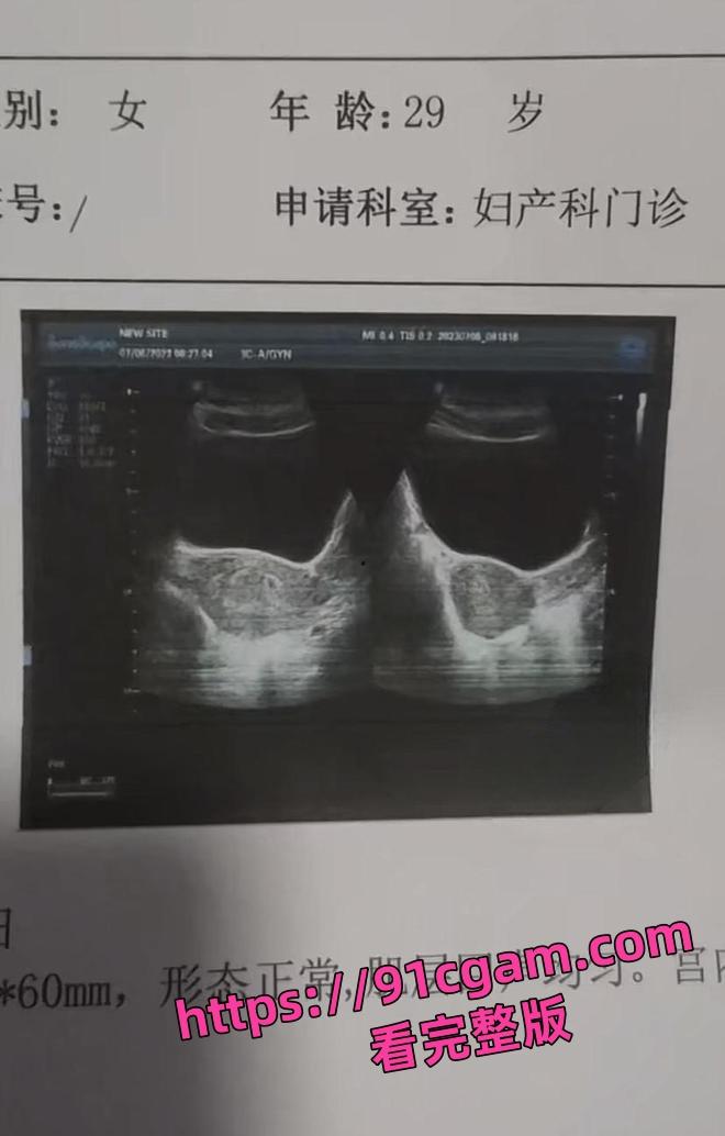 妻子实名举报！河南开封通许县孙营乡干部 毛云飞，买官出轨拿刀砍妻子-5